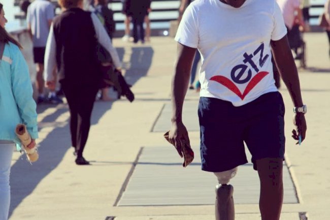 I lost my leg but found my purpose! South African shares inspiring story!